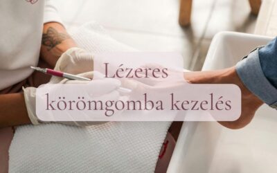 Lézeres körömgomba kezelés
