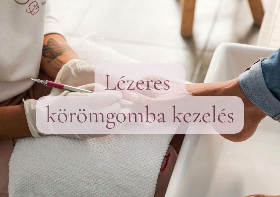 Lézeres körömgomba kezelés