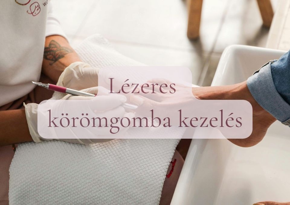 Lézeres körömgomba kezelés
